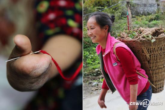 85后殘疾女用獨(dú)指彈出生活強(qiáng)音